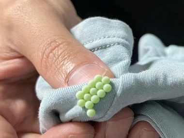 和顺除四害灭虫所家里有臭虫到底该怎么办